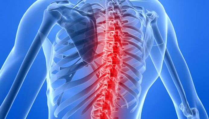 Patologias da coluna vertebral são as causas mais comuns de dor nas costas na região da omoplata