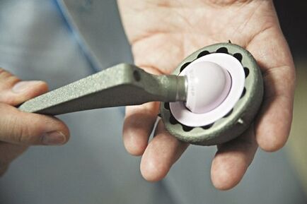 cirurgia para artrose