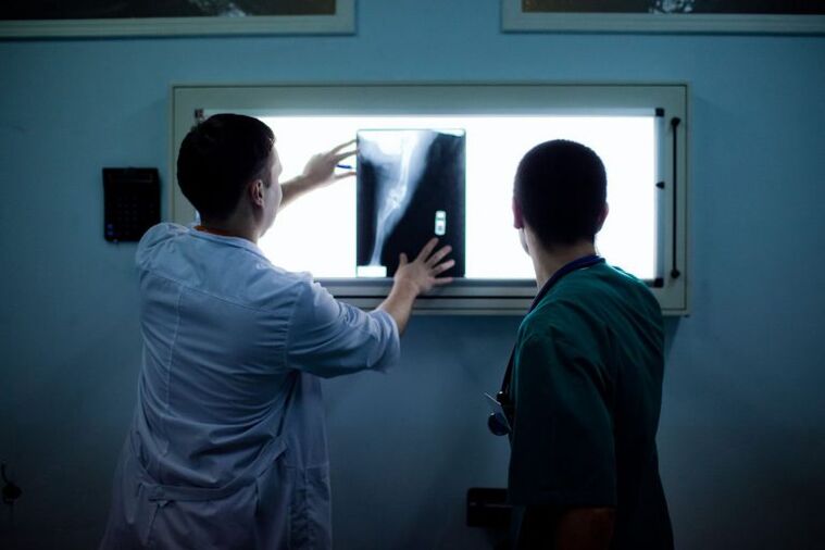 Diagnóstico de artrose em X -Ray