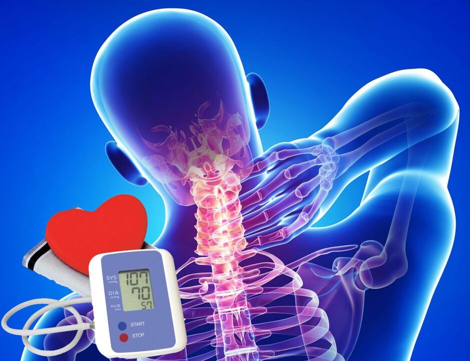 Saltos na pressão arterial com osteocondrose cervical