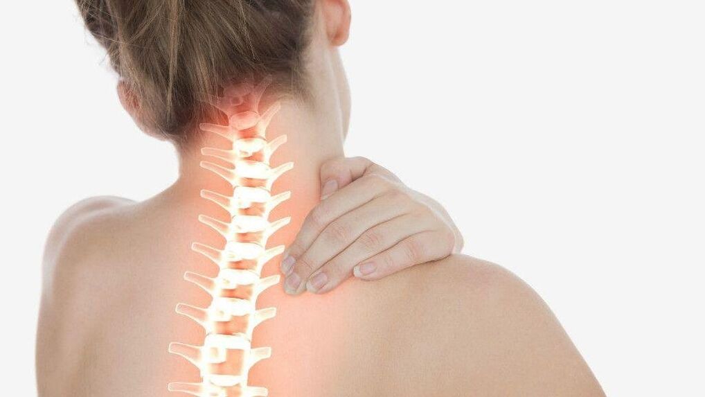 Com osteocondrose da coluna cervical, pode ocorrer síndrome radicular